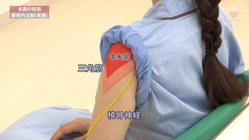 筋肉内注射（実施） ｜ Medical*Online Video