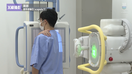 X線撮影 脊椎 外傷患者の撮影法 ｜ Medical*Online Video