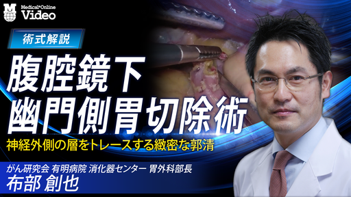 腹腔鏡下幽門側胃切除術 ｜ Medical*Online Video