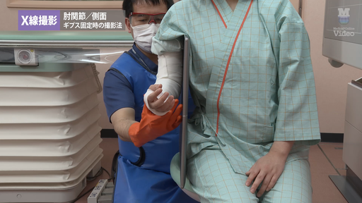 X線撮影 脊椎 外傷患者の撮影法 ｜ Medical*Online Video