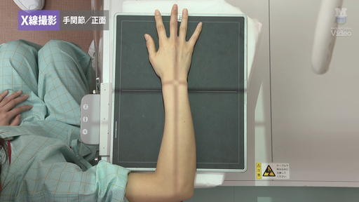 X線撮影法 X線撮影 手関節／正面 外傷患者の撮影法 ｜ Medical*Online Video
