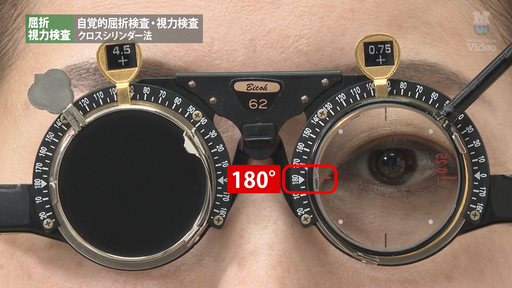 屈折・視力検査 自覚的屈折検査・視力検査 視力検査 ｜ Medical*Online