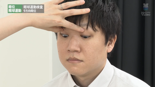 両眼視機能検査 立体視検査 Lang stereo test ｜ Medical*Online