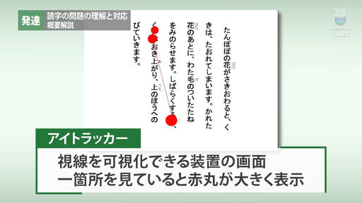 言語障害と画像診断 ＋ 失語症の理解のために 失語症の皆さんがお見えになりました」は、なぜあのような書き方