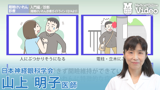 眼瞼けいれん診療 入門編 診断 ｜ Medical*Online Video