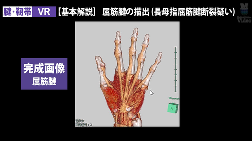 触診 軟部組織 足部・足底 ｜ Medical*Online Video