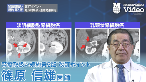 脳腫瘍取扱い規約第5版　おーむ 臨床・病理 脳腫瘍取扱い規約 第5版 | 日本脳神経外科学会, 日本