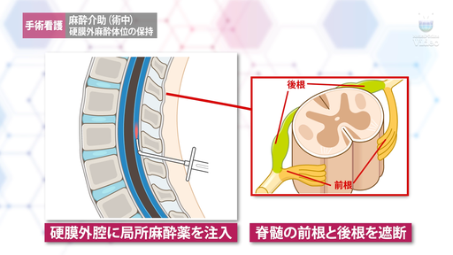 患者ケア（術中） 体温管理 ｜ Medical*Online Video