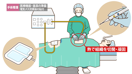 麻酔介助（術中） 硬膜外麻酔体位の保持 ｜ Medical*Online Video