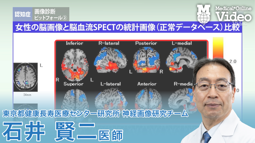 認知症 画像診断 ｜ Medical*Online Video