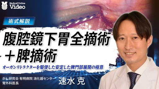 腹腔鏡下幽門側胃切除術 ｜ Medical*Online Video